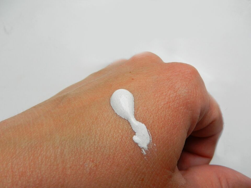 Photo of intenskin cream on hand from review Elizabeth from Dublin
