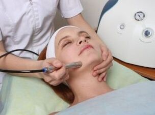 Laser facial rejuvenation