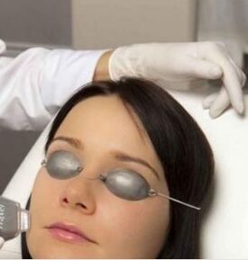 Rejuvenating the field laser