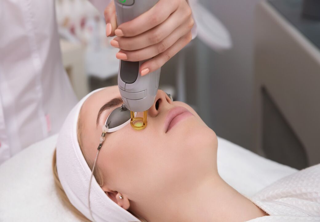 Laser rejuvenation