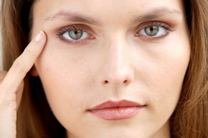Wrinkles around the eyes