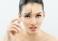 A girl after fractional laser facial rejuvenation