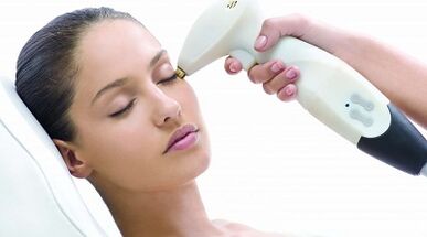 How fractional skin rejuvenation is performed
